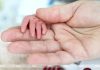 Правительством утвержден порядок предоставления бесплатных попыток ЭКО
